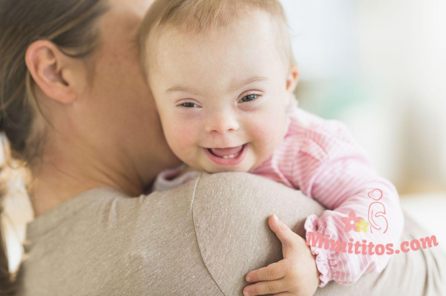 Lactancia materna de un niño con síndrome de Down